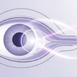 Brief Guide to CPT Code 66821